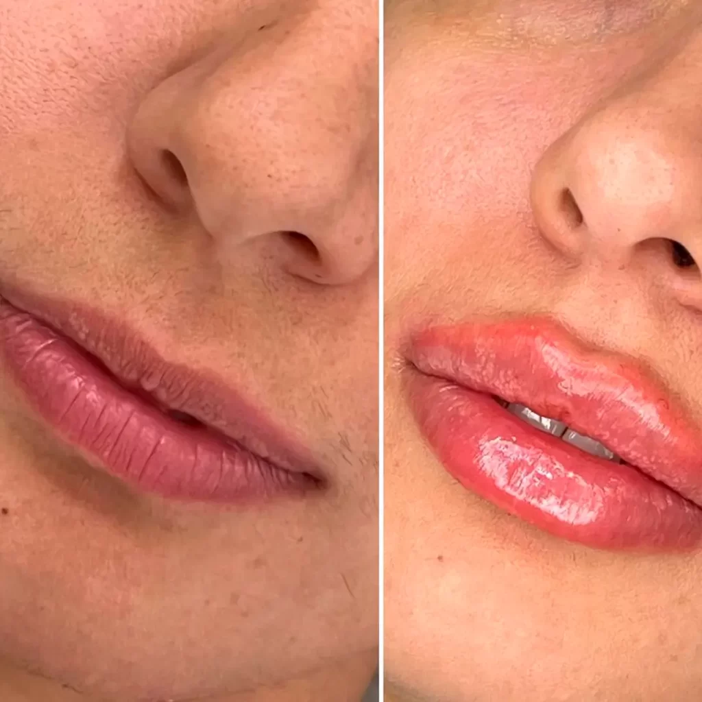 Escultura Labial